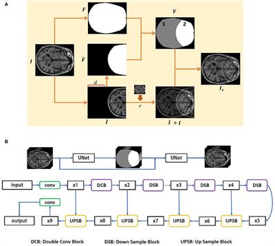 Simulation and Mitigation of the Wrap-Around Artifact in the MRI Image